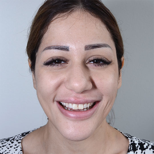 Noor före