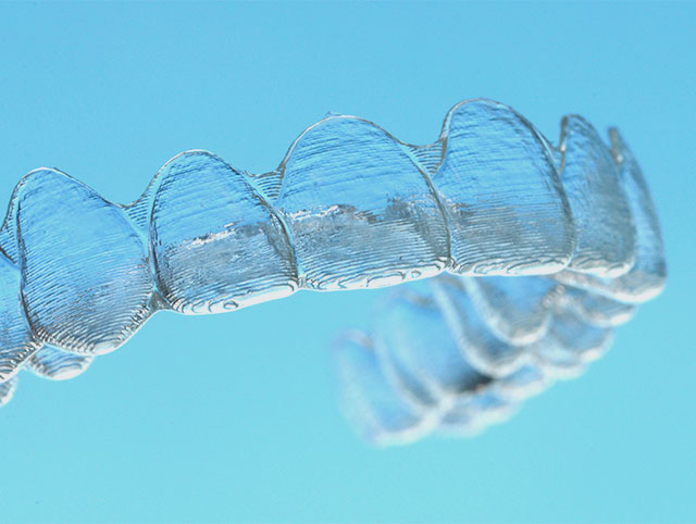 Closeup of clear aligners
